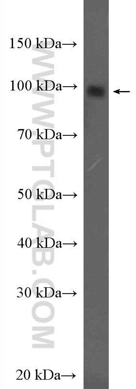 WB analysis of MCF-7 using 26854-1-AP