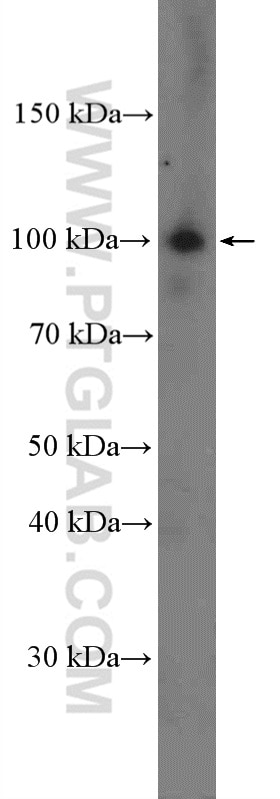 Western Blot (WB) analysis of mouse lung tissue using NOP14 Polyclonal antibody (26854-1-AP)