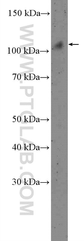 Western Blot (WB) analysis of rat kidney tissue using NOP14 Polyclonal antibody (26854-1-AP)