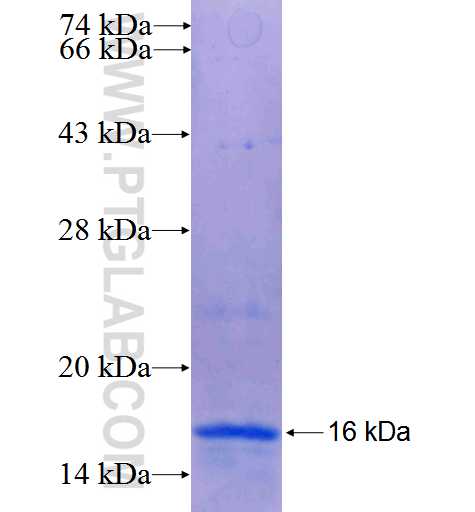 NOP14 fusion protein Ag25476 SDS-PAGE