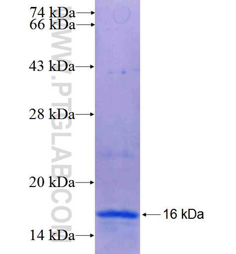 NOP14 fusion protein Ag25476 SDS-PAGE