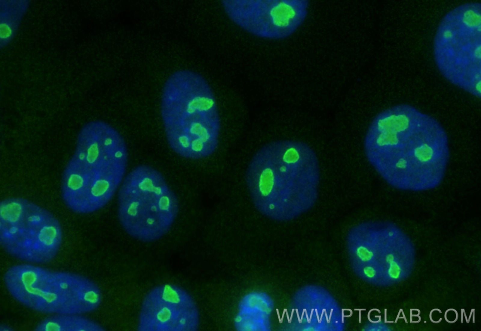 Immunofluorescence (IF) / fluorescent staining of A431 cells using NOP16 Polyclonal antibody (31969-1-AP)
