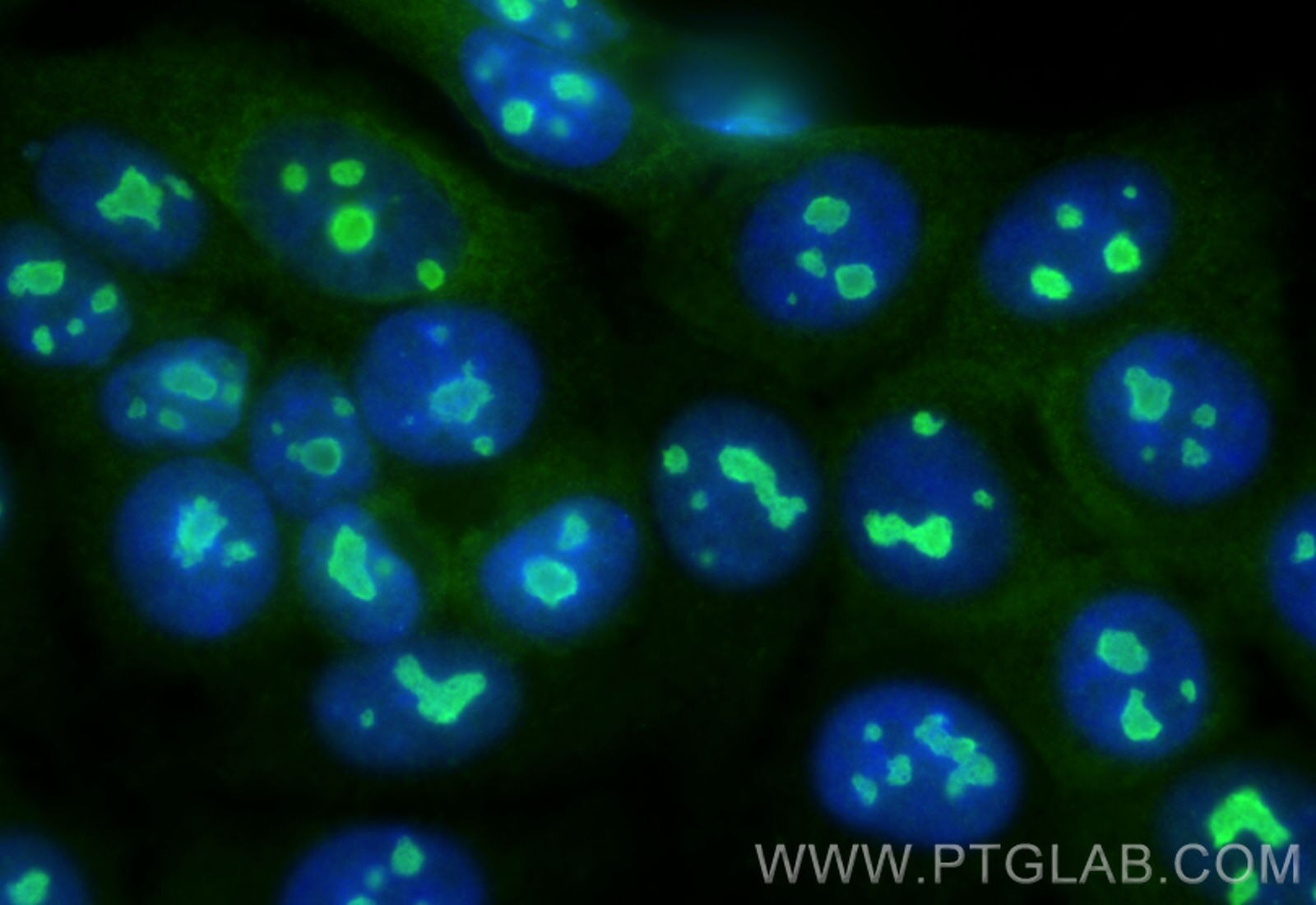 Immunofluorescence (IF) / fluorescent staining of MCF-7 cells using NOP16 Polyclonal antibody (31969-1-AP)
