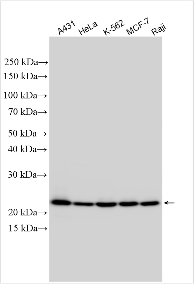 Western Blot (WB) analysis of various lysates using NOP16 Polyclonal antibody (31969-1-AP)