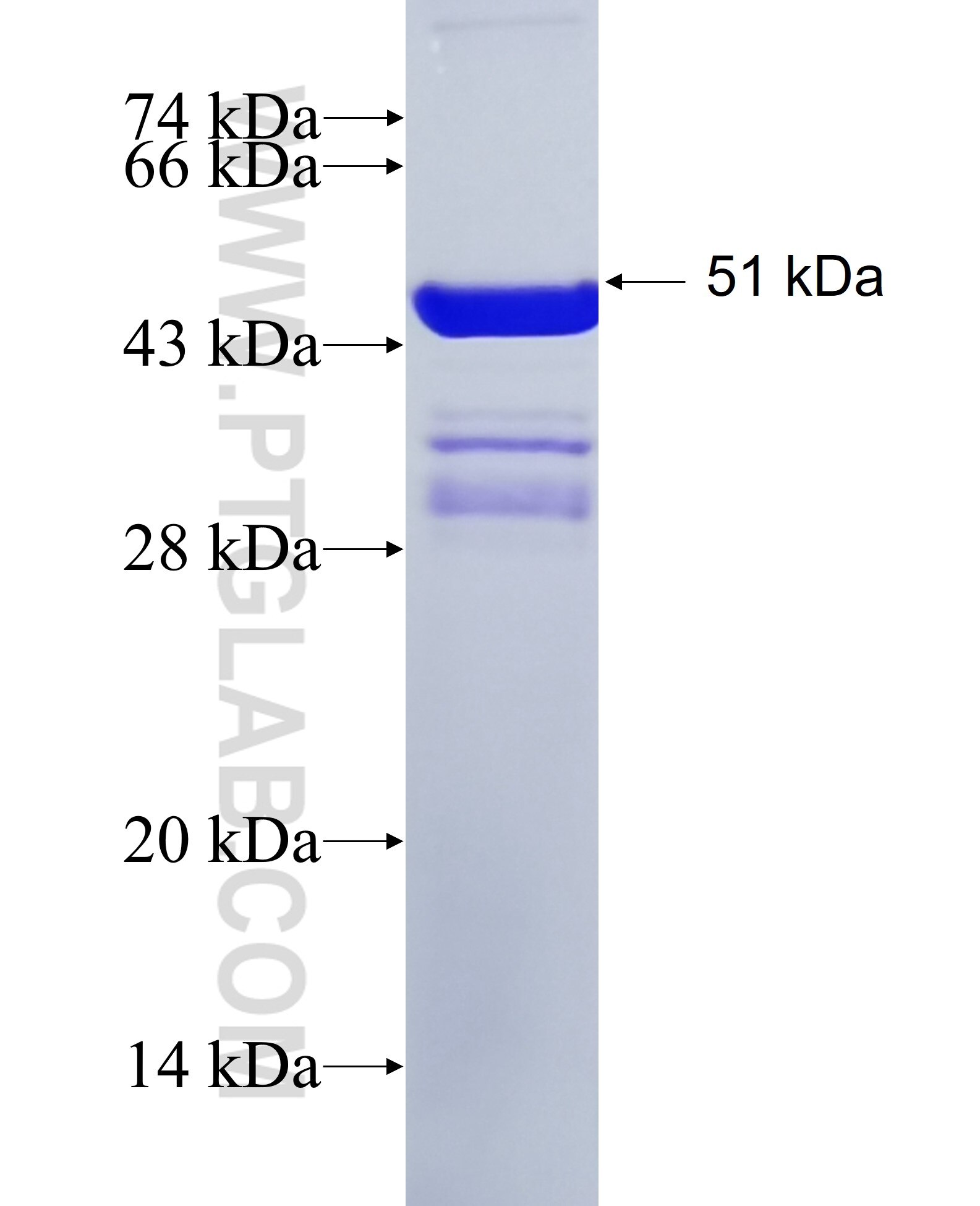 NOP16 fusion protein Ag36714 SDS-PAGE
