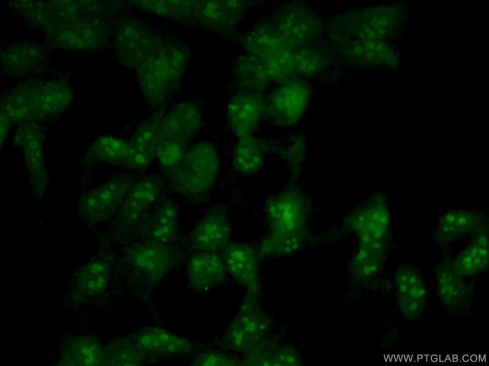 Immunofluorescence (IF) / fluorescent staining of HEK-293 cells using NOP2 Polyclonal antibody (10448-1-AP)
