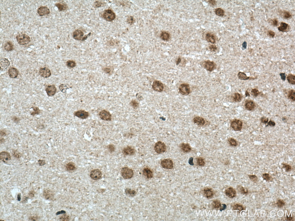 Immunohistochemistry (IHC) staining of mouse brain tissue using NOP2 Polyclonal antibody (10448-1-AP)