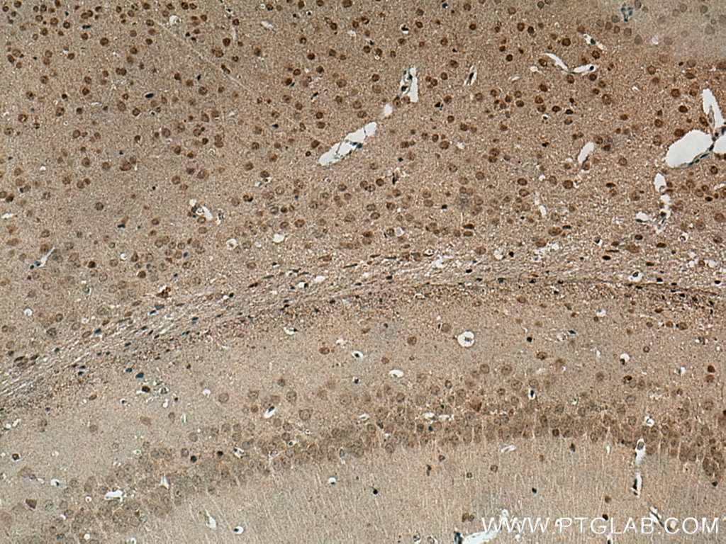 Immunohistochemistry (IHC) staining of mouse brain tissue using NOP2 Polyclonal antibody (10448-1-AP)