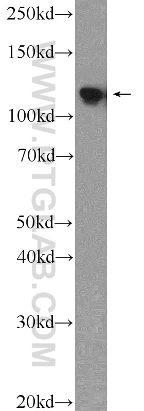 Western Blot (WB) analysis of A2780 cells using NOP2 Polyclonal antibody (10448-1-AP)