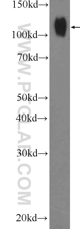 WB analysis of C6 using 10448-1-AP