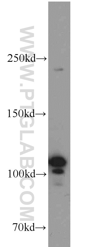 Western Blot (WB) analysis of HeLa cells using NOP2 Polyclonal antibody (10448-1-AP)