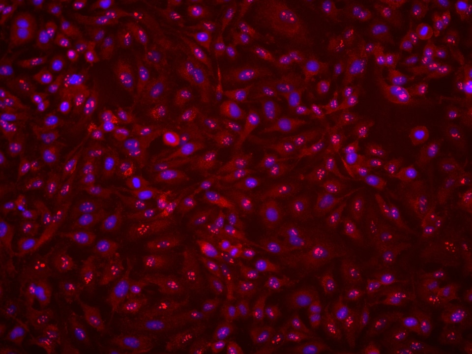 Immunofluorescence (IF) / fluorescent staining of HeLa cells using NOP2 Monoclonal antibody (68889-1-Ig)