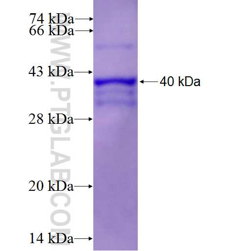 NOP2 fusion protein Ag0498 SDS-PAGE