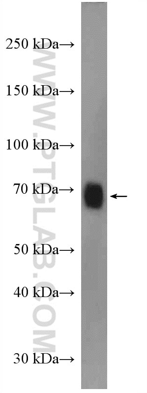 Western Blot (WB) analysis of A549 cells using NOP56 Polyclonal antibody (18181-1-AP)