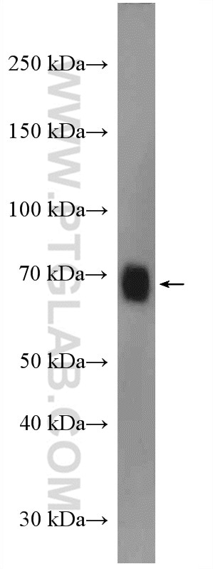 WB analysis of A549 using 18181-1-AP