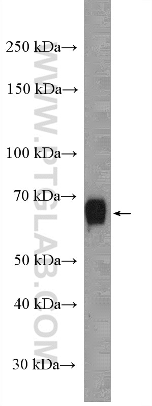 Western Blot (WB) analysis of NIH/3T3 cells using NOP56 Polyclonal antibody (18181-1-AP)
