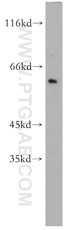 Western Blot (WB) analysis of HeLa cells using NOP56 Polyclonal antibody (18181-1-AP)