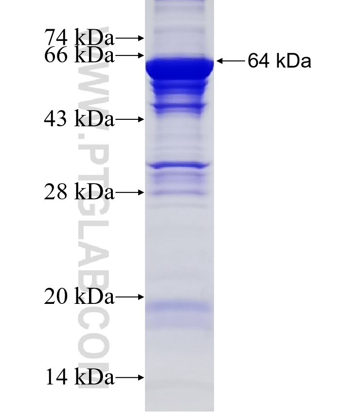 NOP56 fusion protein Ag12882 SDS-PAGE