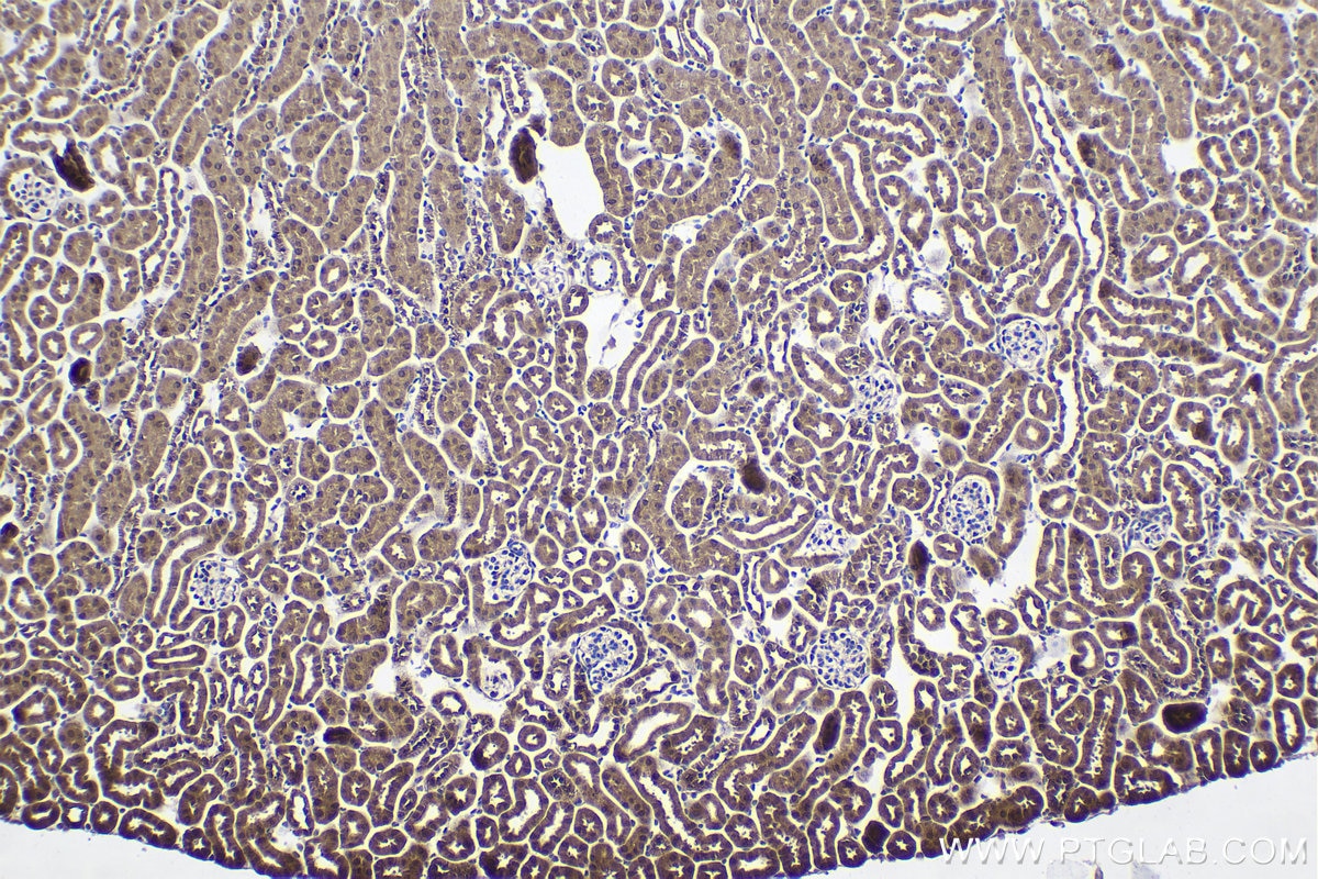 Immunohistochemistry (IHC) staining of mouse kidney tissue using NOP58 Polyclonal antibody (14409-1-AP)