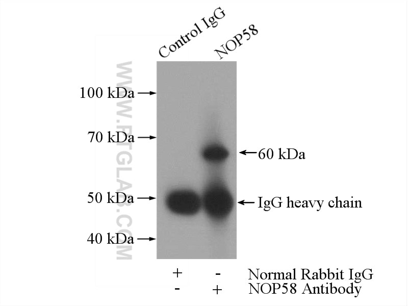 Immunoprecipitation (IP) experiment of K-562 cells using NOP58 Polyclonal antibody (14409-1-AP)