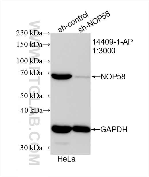Western Blot (WB) analysis of HeLa cells using NOP58 Polyclonal antibody (14409-1-AP)