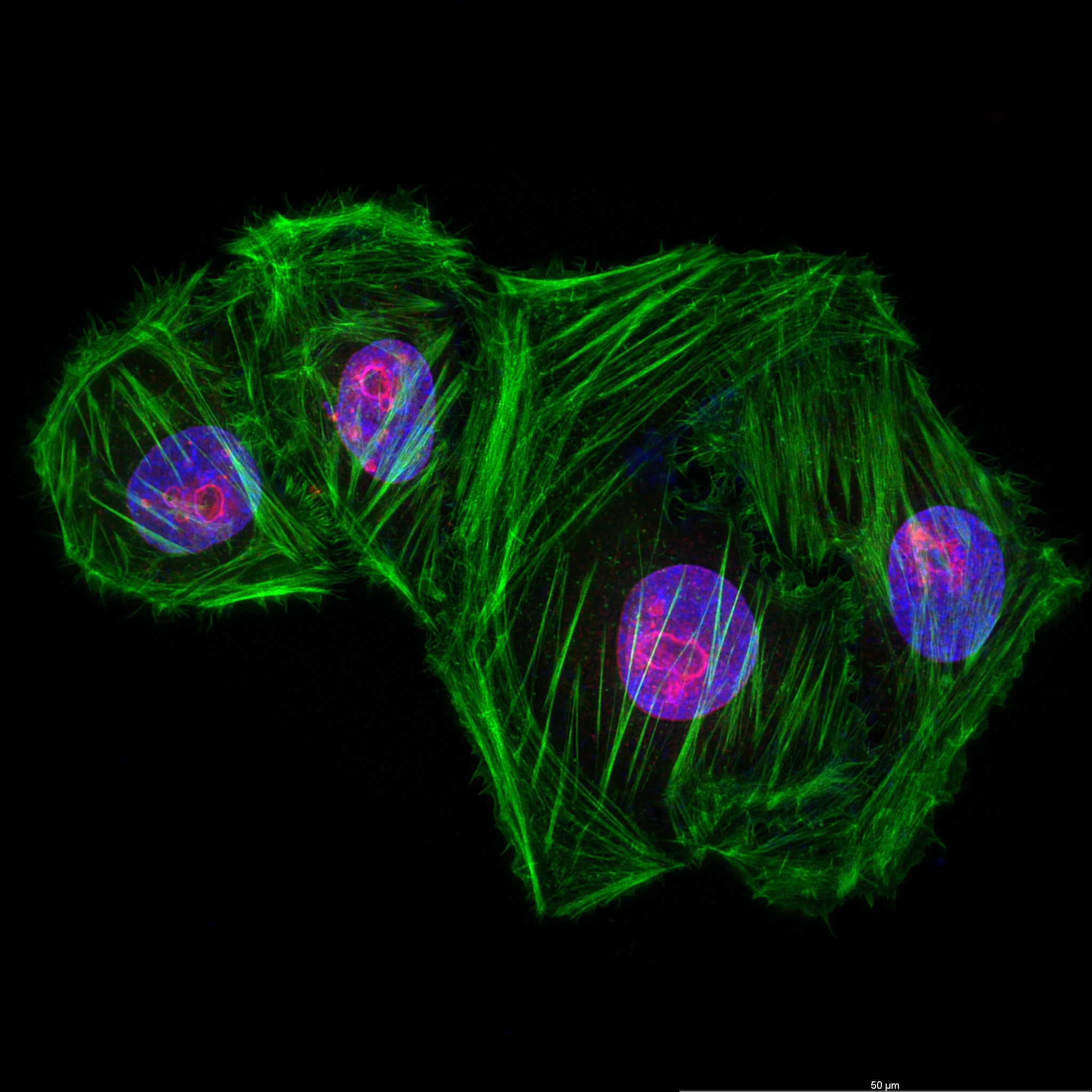 Immunofluorescence (IF) / fluorescent staining of U2OS cells using NOP58 Recombinant antibody (82879-1-RR)