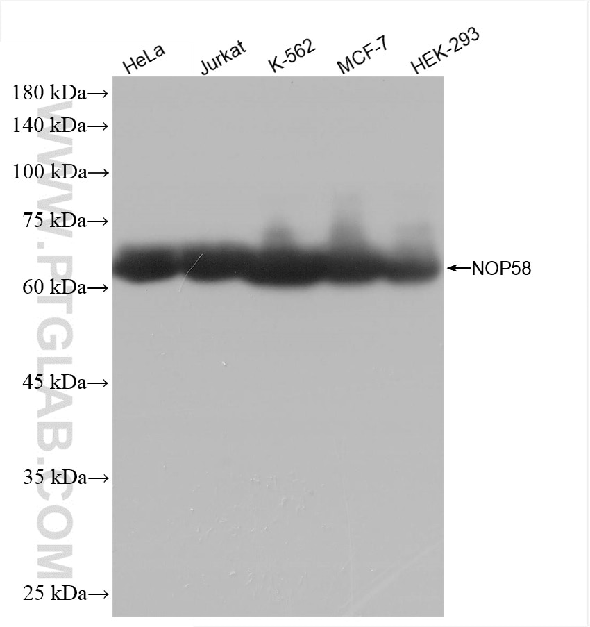 Western Blot (WB) analysis of various lysates using NOP58 Recombinant antibody (82879-1-RR)