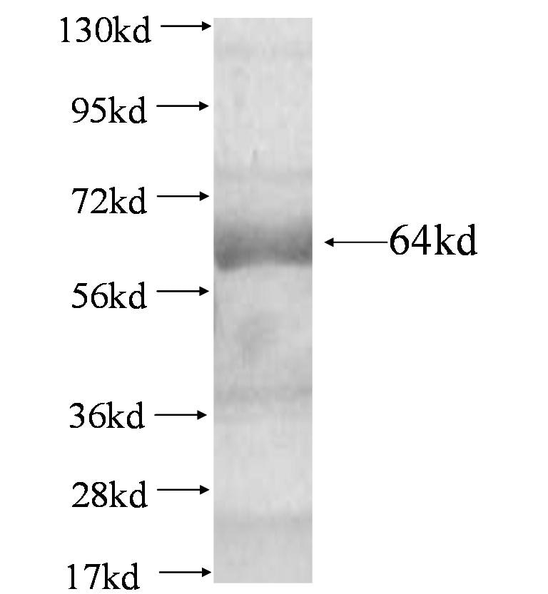 NOP58 fusion protein Ag4331 SDS-PAGE