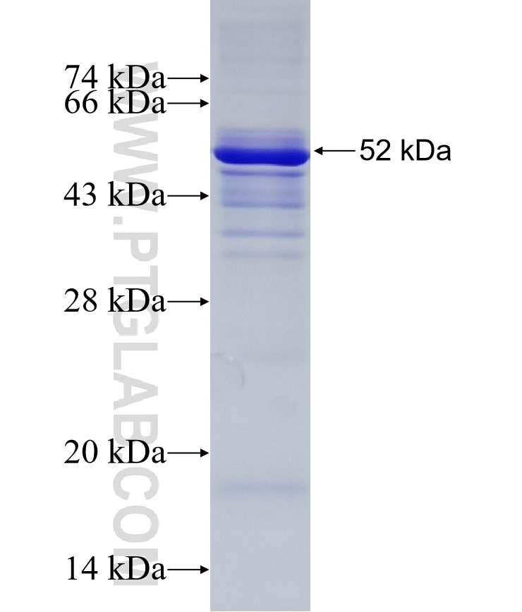 NOP58 fusion protein Ag5740 SDS-PAGE