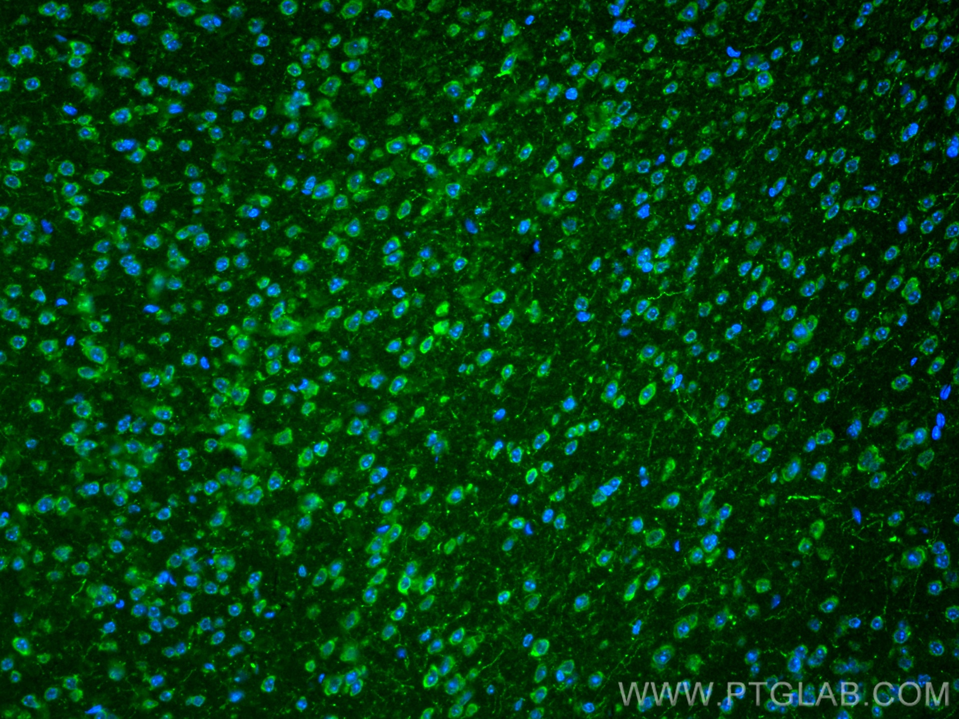 Immunofluorescence (IF) / fluorescent staining of mouse brain tissue using nNOS Polyclonal antibody (29231-1-AP)