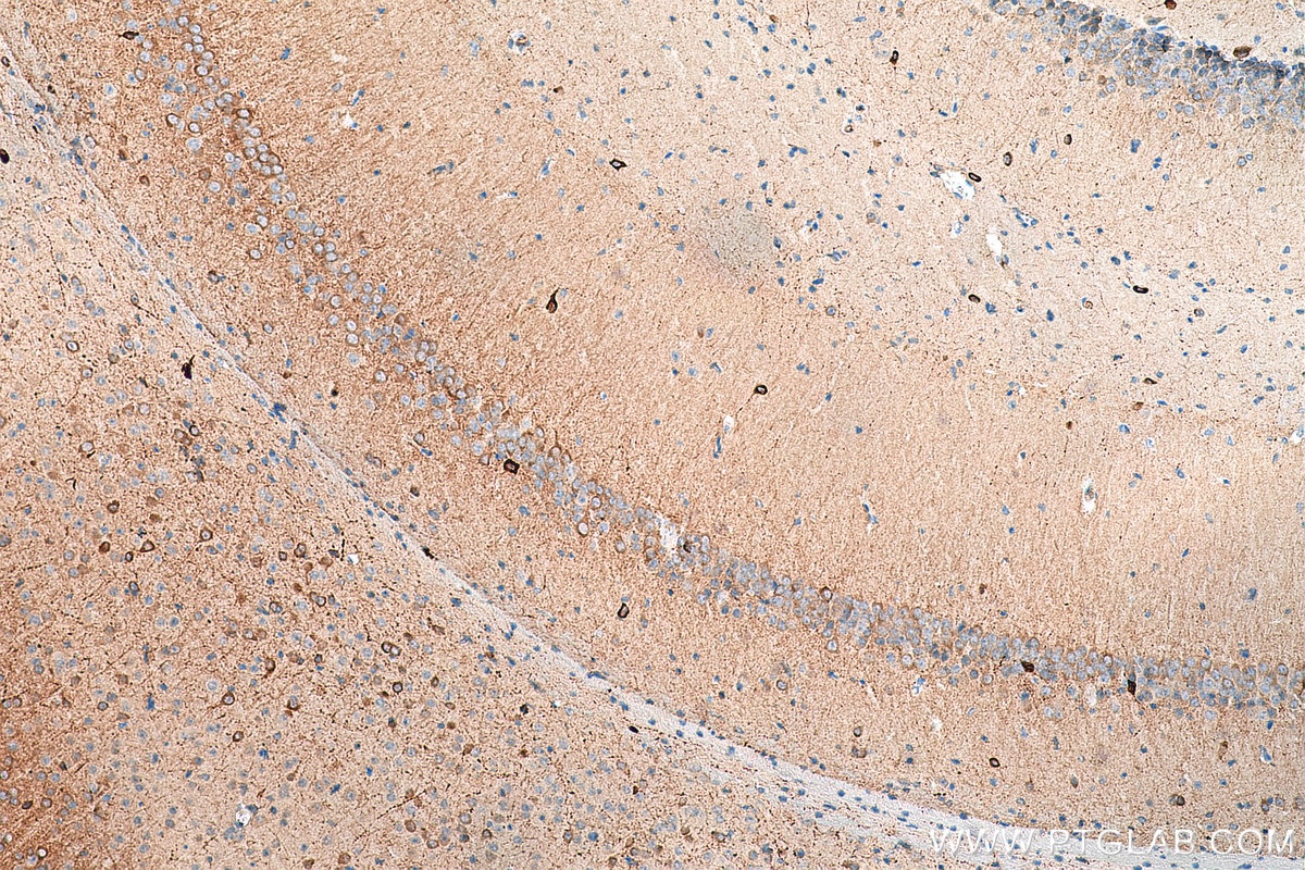 Immunohistochemistry (IHC) staining of mouse brain tissue using nNOS Polyclonal antibody (29231-1-AP)