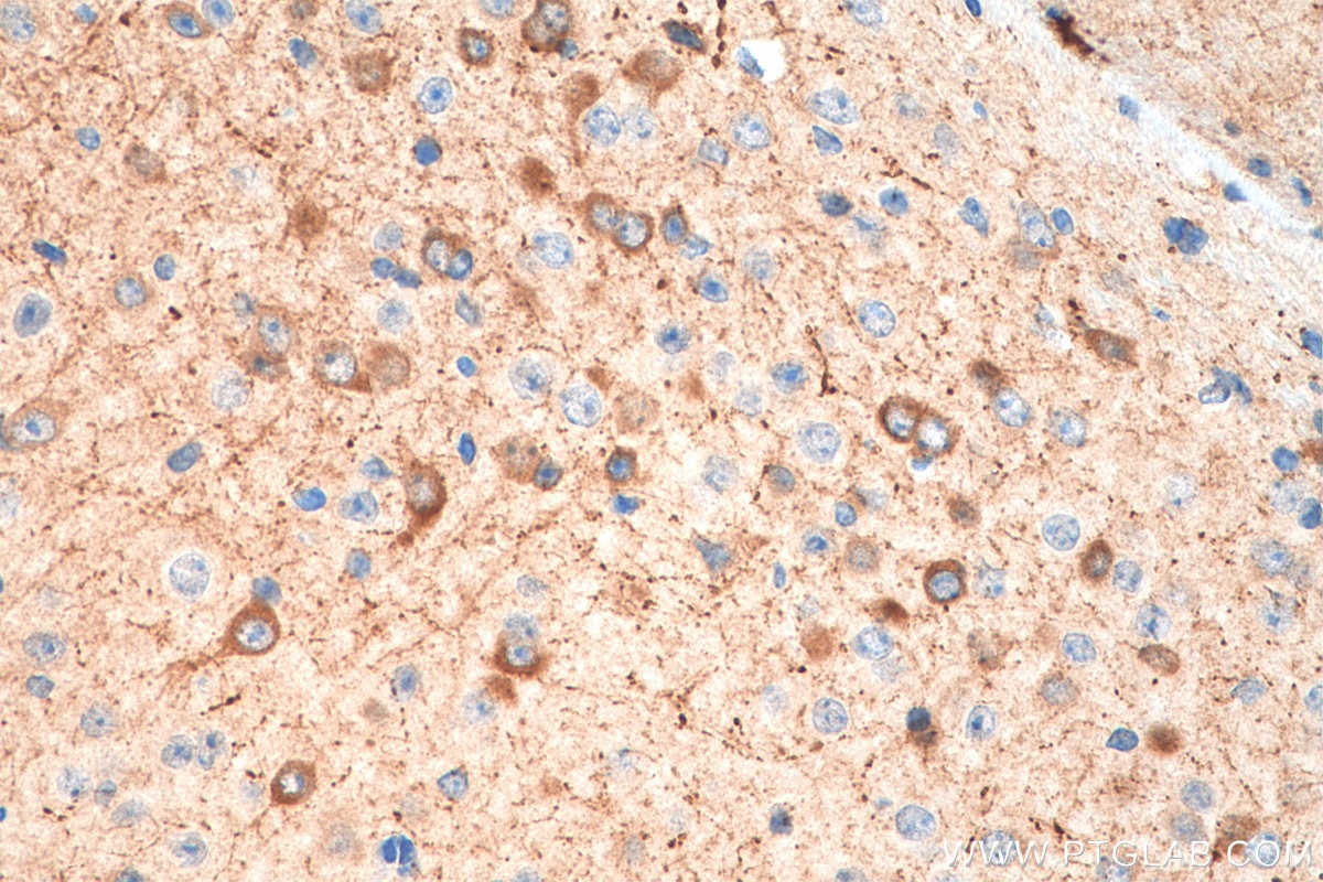 Immunohistochemistry (IHC) staining of mouse brain tissue using nNOS Polyclonal antibody (29231-1-AP)