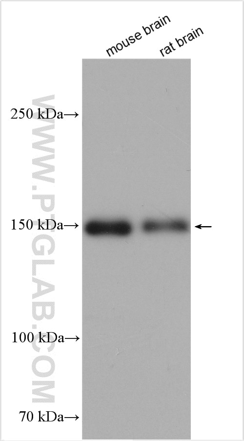 Western Blot (WB) analysis of various lysates using nNOS Polyclonal antibody (29231-1-AP)