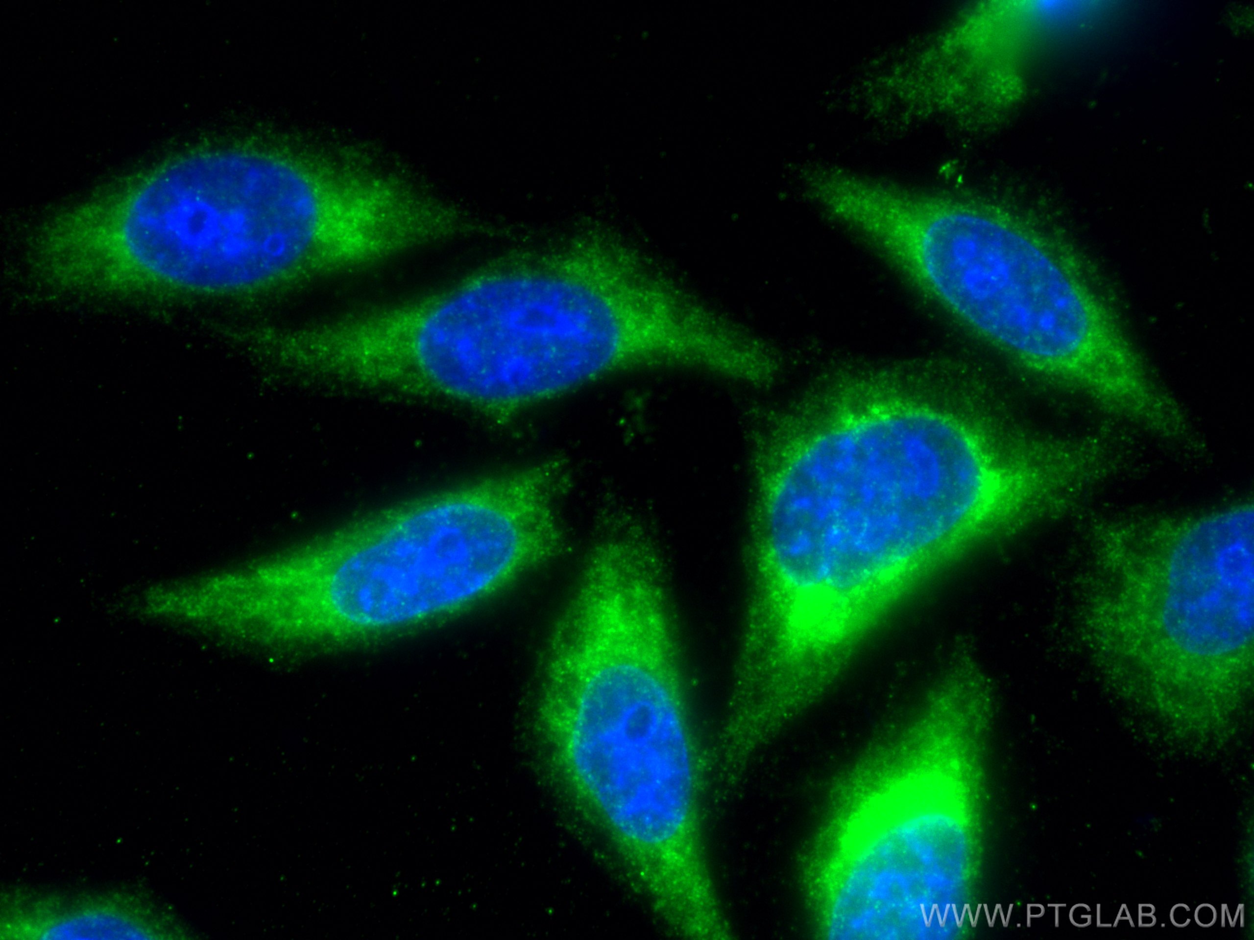 Immunofluorescence (IF) / fluorescent staining of HepG2 cells using iNOS Polyclonal antibody (18985-1-AP)