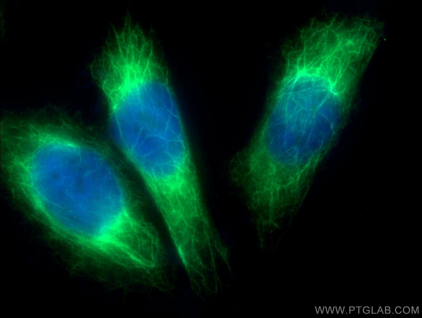 IF Staining of HeLa using 18985-1-AP