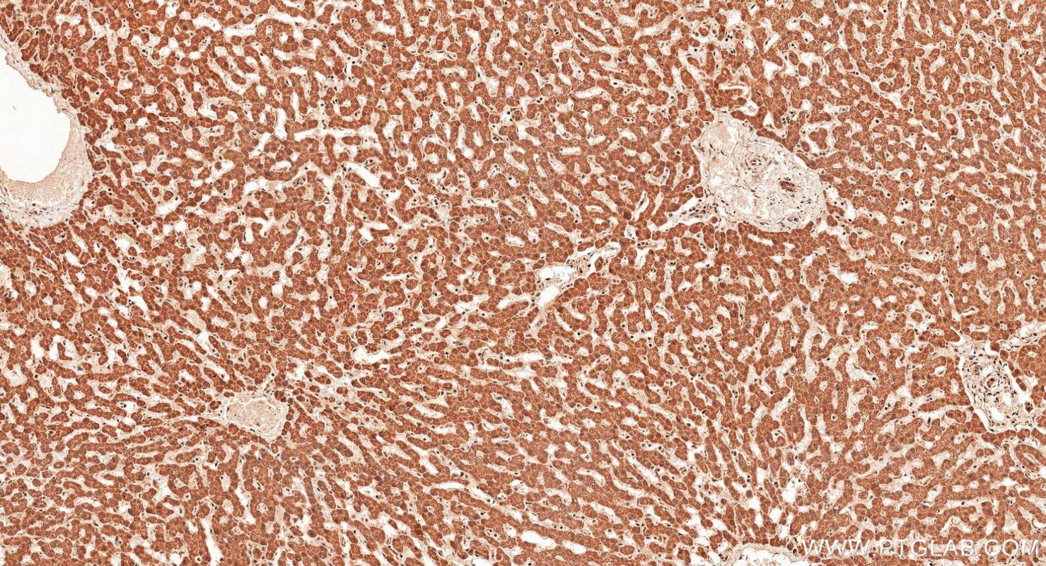 Immunohistochemistry (IHC) staining of human liver tissue using iNOS Polyclonal antibody (18985-1-AP)
