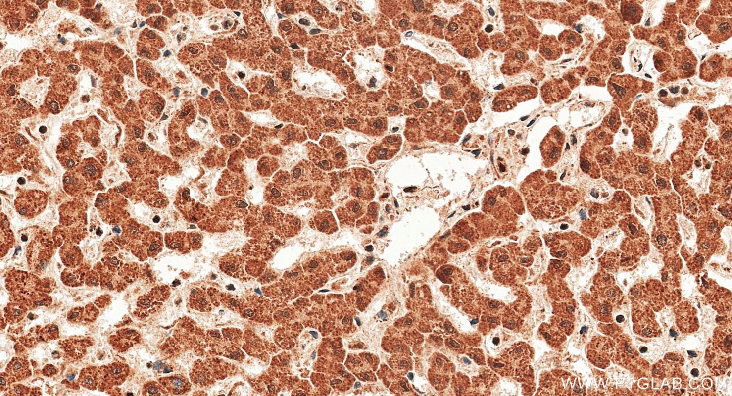 Immunohistochemistry (IHC) staining of human liver tissue using iNOS Polyclonal antibody (18985-1-AP)
