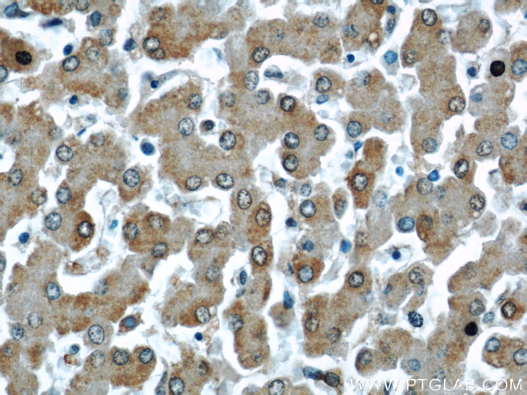 iNOS Polyclonal antibody