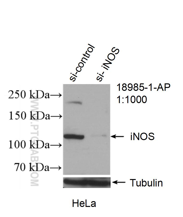Western Blot (WB) analysis of HeLa cells using iNOS Polyclonal antibody (18985-1-AP)
