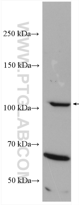 Western Blot (WB) analysis of HeLa cells using iNOS Polyclonal antibody (18985-1-AP)