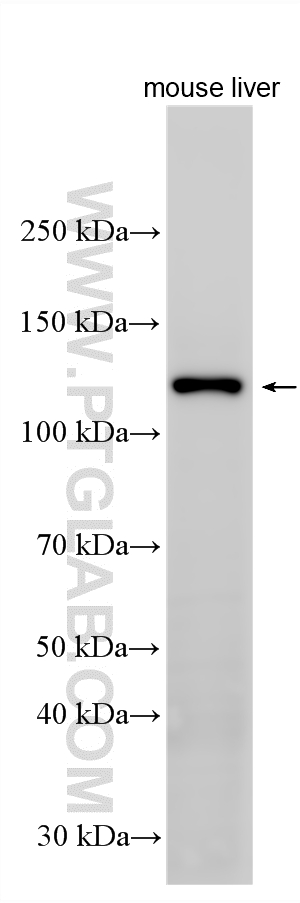 Western Blot (WB) analysis of various lysates using iNOS Polyclonal antibody (18985-1-AP)