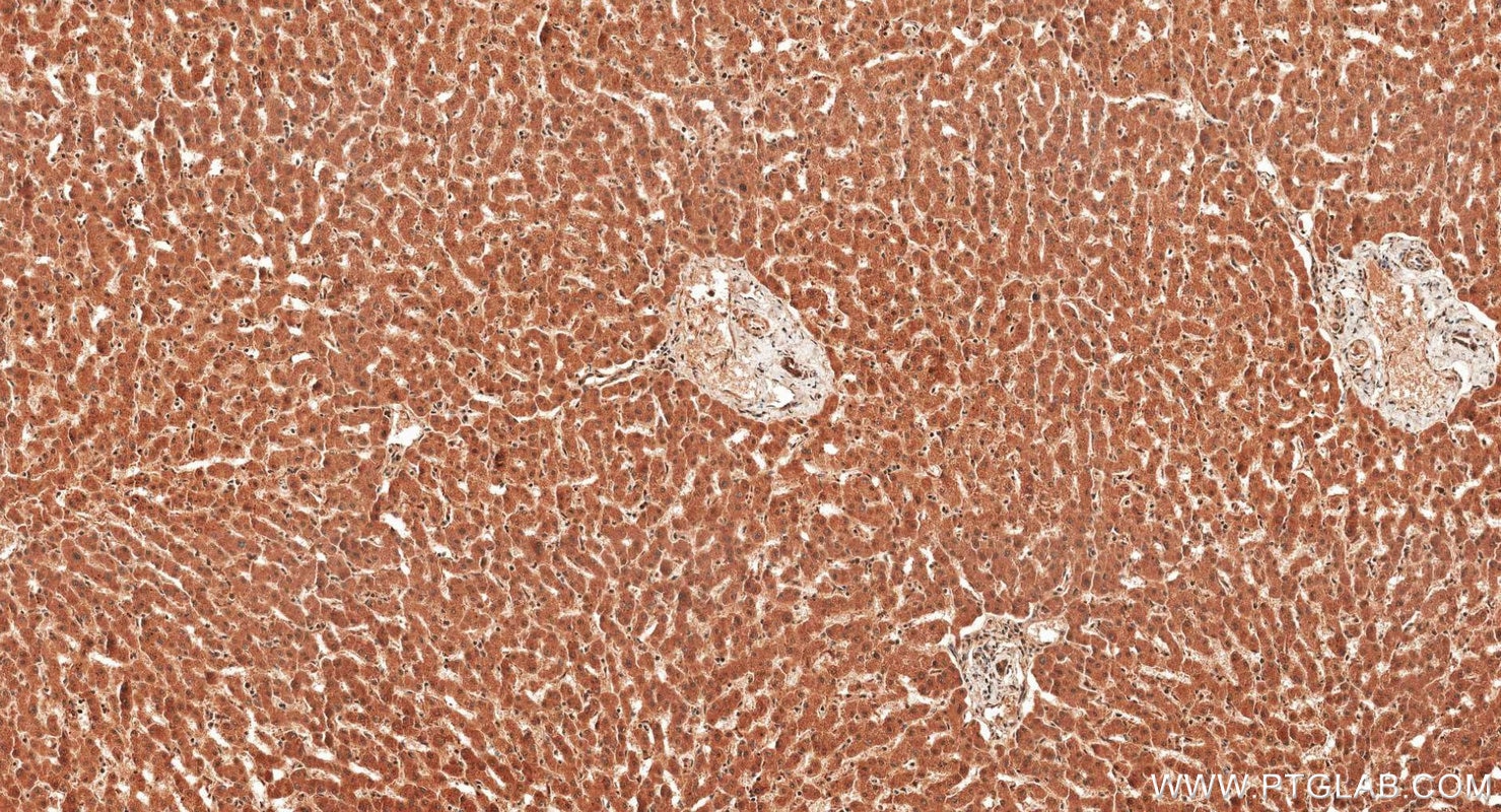 Immunohistochemistry (IHC) staining of human liver tissue using iNOS Polyclonal antibody (22226-1-AP)