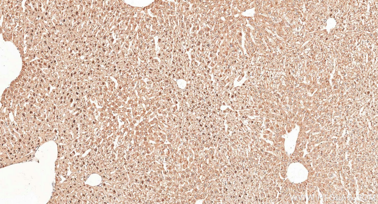 Immunohistochemistry (IHC) staining of mouse liver tissue using iNOS Polyclonal antibody (22226-1-AP)