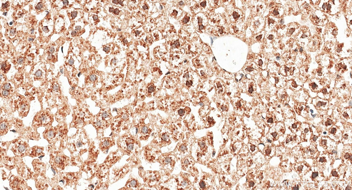 Immunohistochemistry (IHC) staining of mouse liver tissue using iNOS Polyclonal antibody (22226-1-AP)