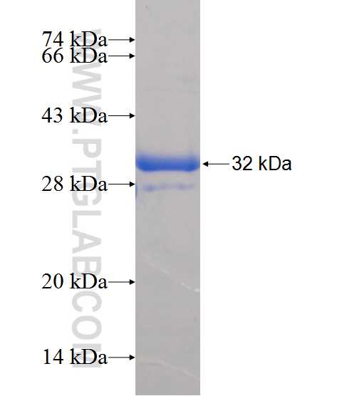 NOS2 fusion protein Ag25101 SDS-PAGE