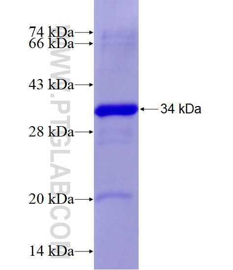 NOS2 fusion protein Ag17696 SDS-PAGE