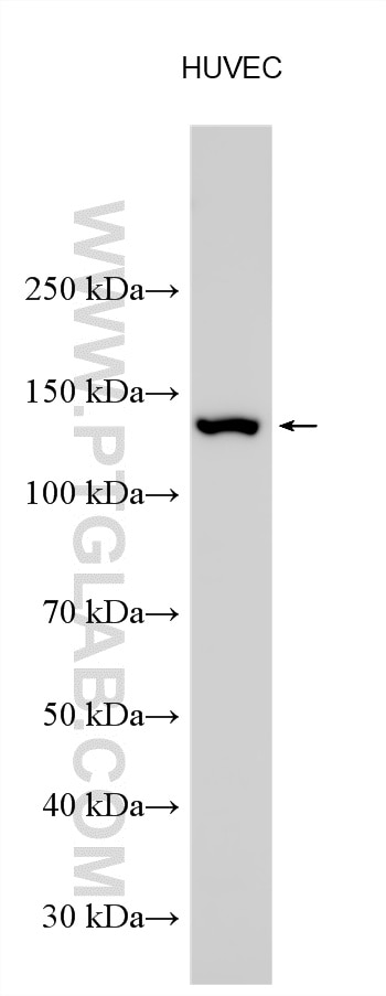 Various lysates were subjected to SDS PAGE followed by western blot with 27120-1-AP (eNOS antibody) at dilution of 1:10000 incubated at room temperature for 1.5 hours. Western Blot (WB) analysis of various lysates using eNOS Polyclonal antibody (27120-1-AP)