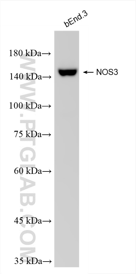 Western Blot (WB) analysis of bEnd.3 cells using NOS3 Recombinant antibody (85020-4-RR)