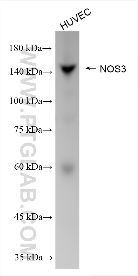Western Blot (WB) analysis of HUVEC cells using NOS3 Recombinant antibody (85020-4-RR)