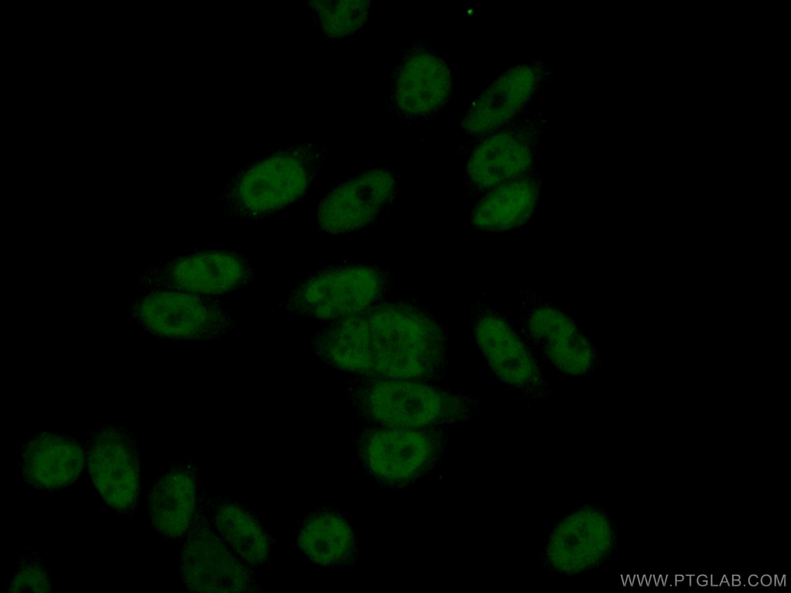 Immunofluorescence (IF) / fluorescent staining of HeLa cells using NOSIP Polyclonal antibody (27979-1-AP)